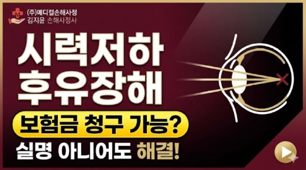 시력저하 후유장해.jpg